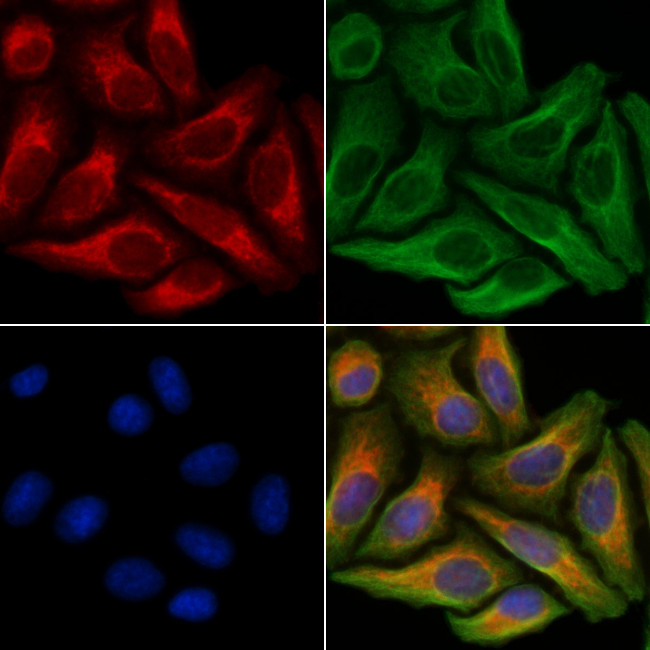 P2Y2 Antibody in Immunocytochemistry (ICC/IF)
