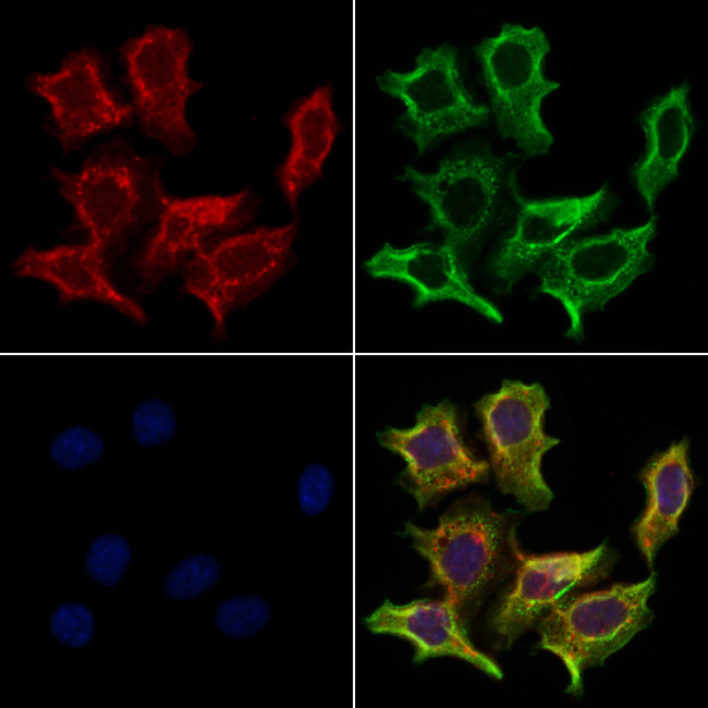 LPAR6 Antibody in Immunocytochemistry (ICC/IF)