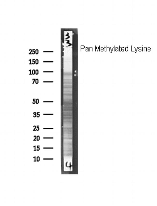 Methylated Lysine Antibody in Western Blot (WB)
