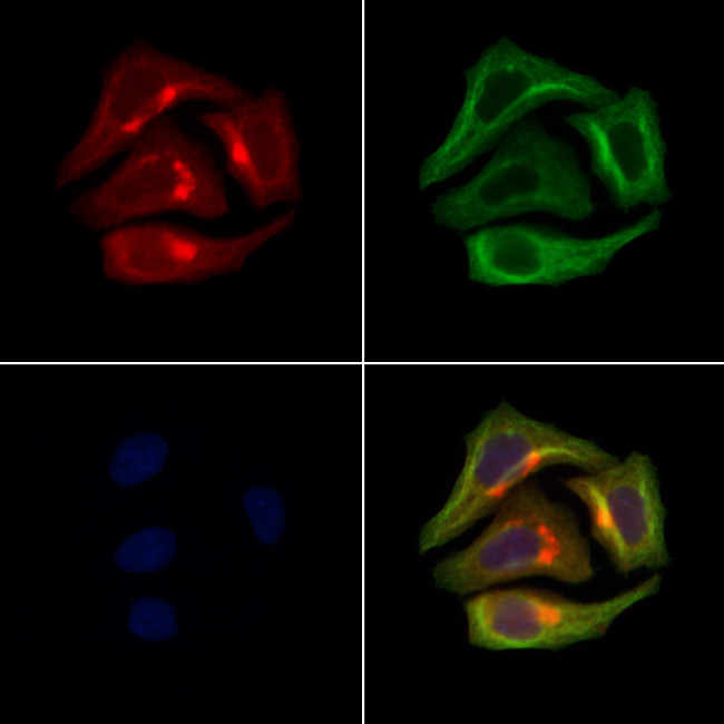 PAPPA2 Antibody in Immunocytochemistry (ICC/IF)
