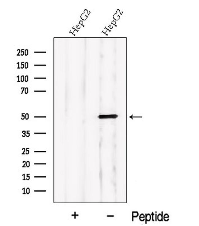 PDE7B Antibody in Western Blot (WB)