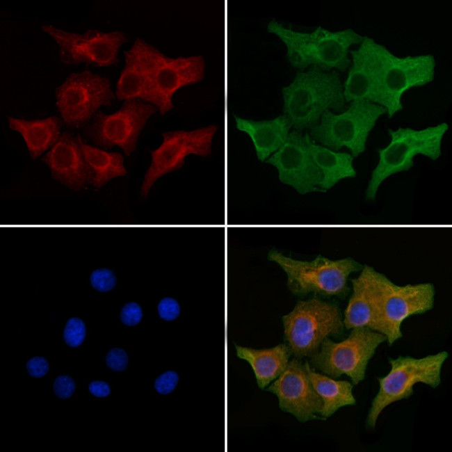 PERP Antibody in Immunocytochemistry (ICC/IF)