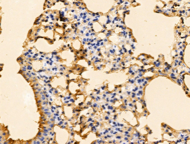 PFDN6 Antibody in Immunohistochemistry (Paraffin) (IHC (P))