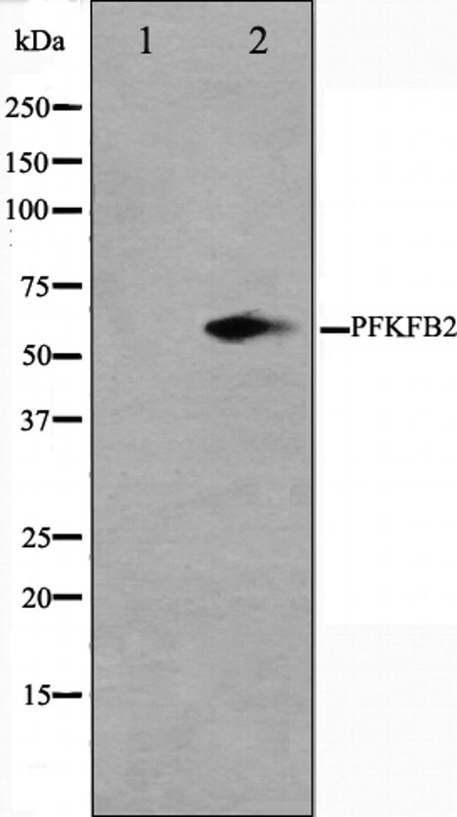 PFKFB2 Antibody in Western Blot (WB)