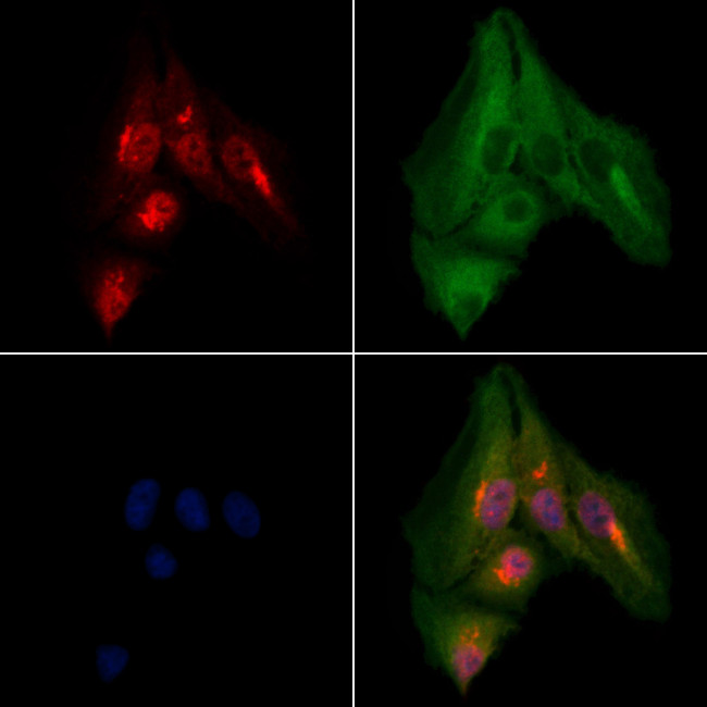 PGP Antibody in Immunocytochemistry (ICC/IF)