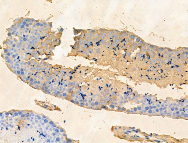 PHF20L1 Antibody in Immunohistochemistry (Paraffin) (IHC (P))