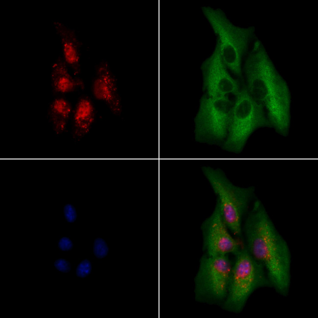 PHOX2B Antibody in Immunocytochemistry (ICC/IF)