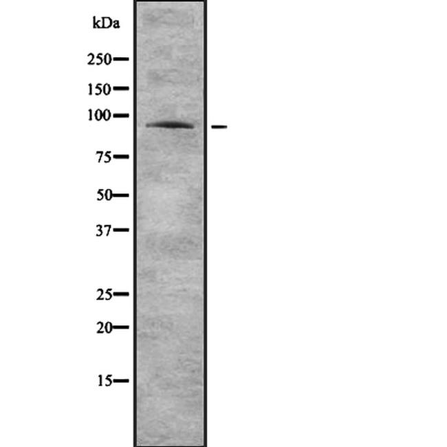PI4KB Antibody in Western Blot (WB)