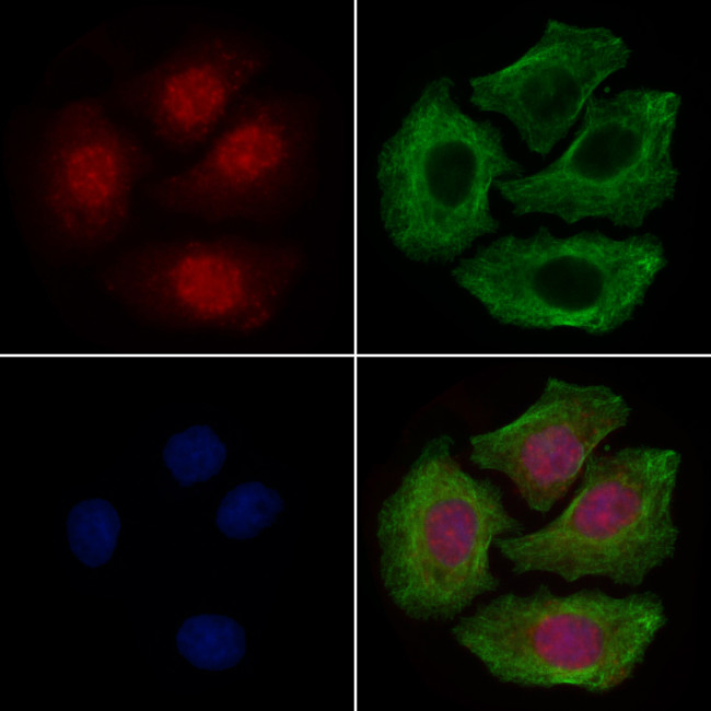 PKA alpha Antibody in Immunocytochemistry (ICC/IF)