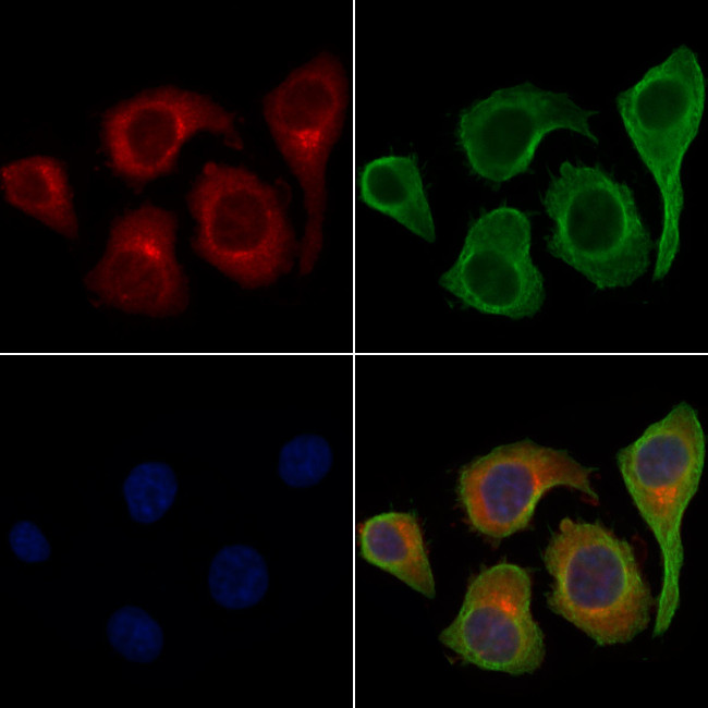 PKC delta Antibody in Immunocytochemistry (ICC/IF)
