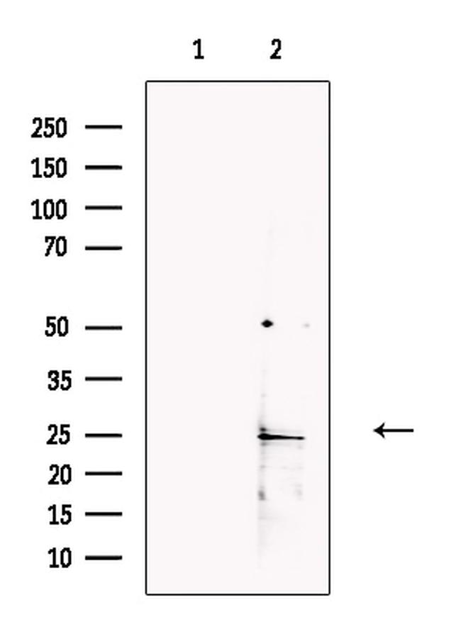 CSH2 Antibody in Western Blot (WB)