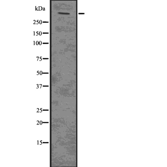 Plectin Antibody in Western Blot (WB)
