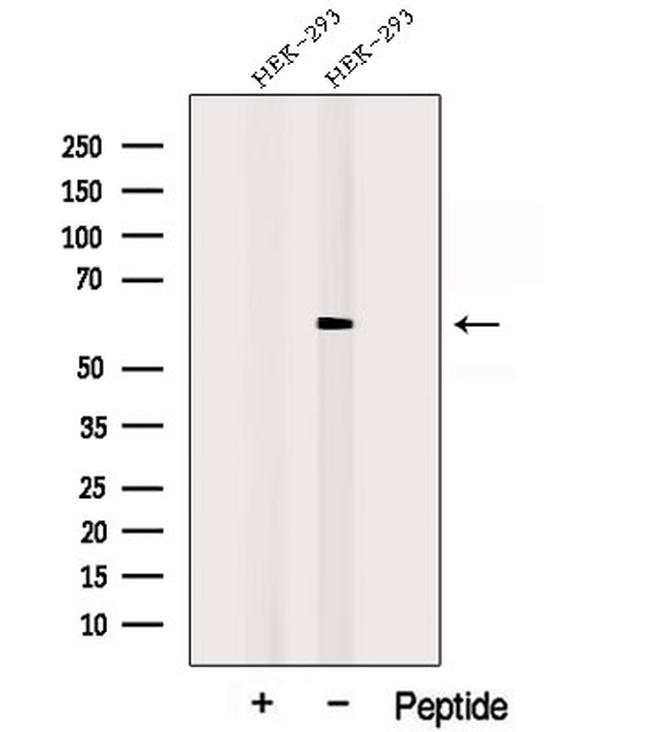 POPDC3 Antibody in Western Blot (WB)
