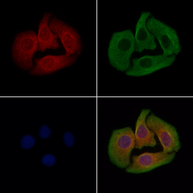 PP2C beta Antibody in Immunocytochemistry (ICC/IF)