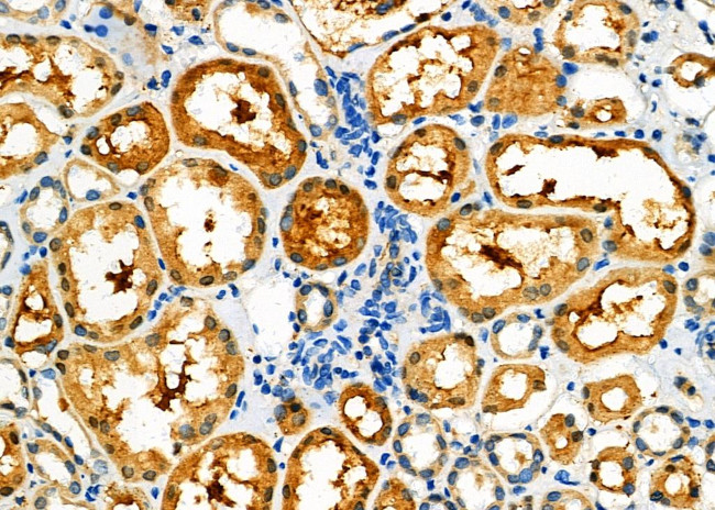 PPP2R2A Antibody in Immunohistochemistry (Paraffin) (IHC (P))