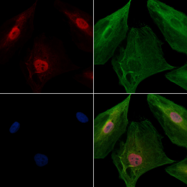 PPP2R5C Antibody in Immunocytochemistry (ICC/IF)