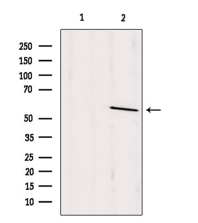 PSAP Antibody in Western Blot (WB)