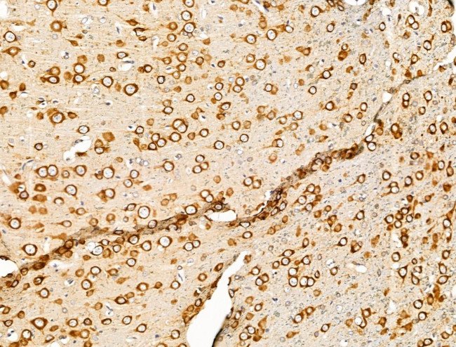 PURA Antibody in Immunohistochemistry (Paraffin) (IHC (P))
