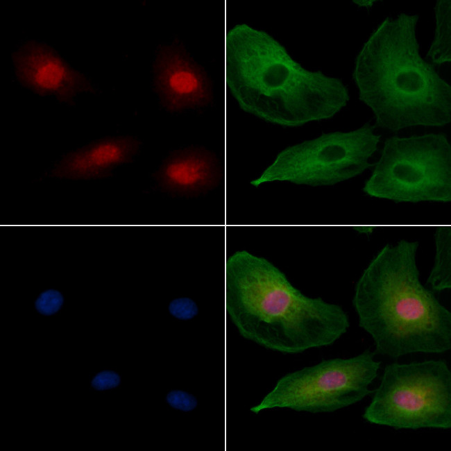 PYGO2 Antibody in Immunocytochemistry (ICC/IF)