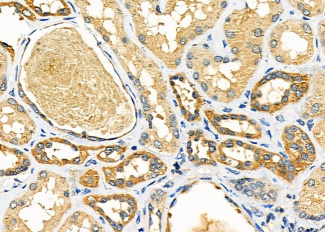 RARRES3 Antibody in Immunohistochemistry (Paraffin) (IHC (P))
