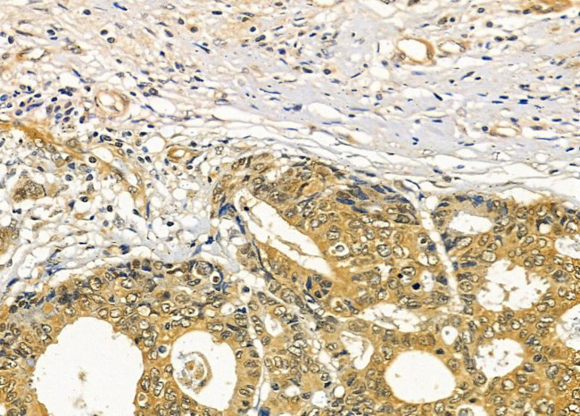 RASA4 Antibody in Immunohistochemistry (Paraffin) (IHC (P))
