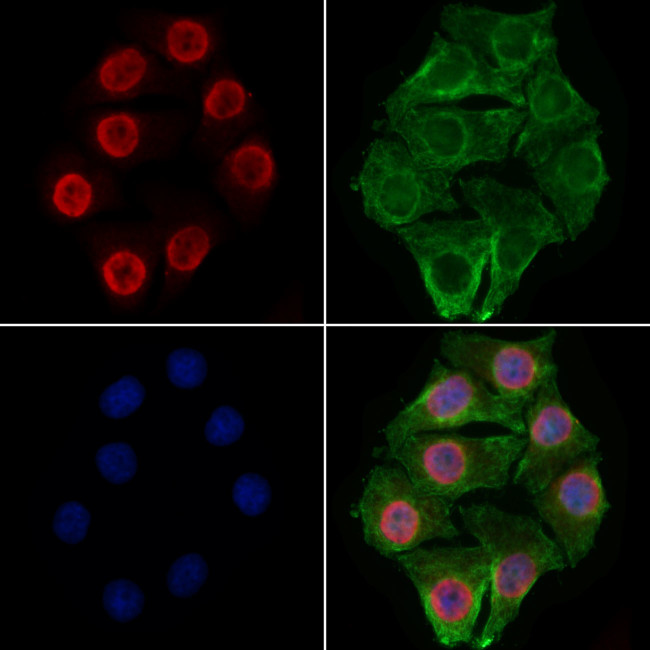 RBM3 Antibody in Immunocytochemistry (ICC/IF)