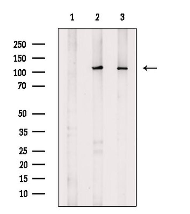 RB1 Antibody in Western Blot (WB)