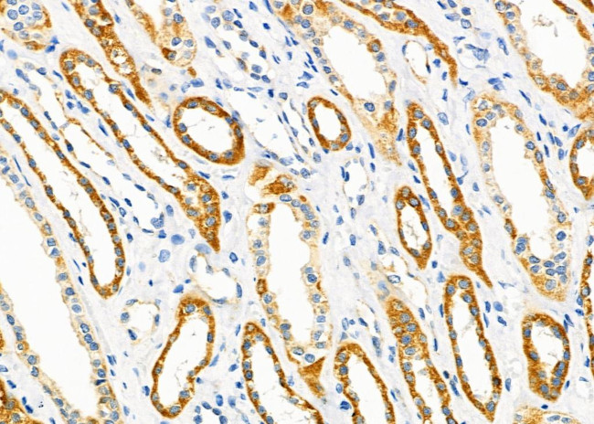 ARHGAP28 Antibody in Immunohistochemistry (Paraffin) (IHC (P))
