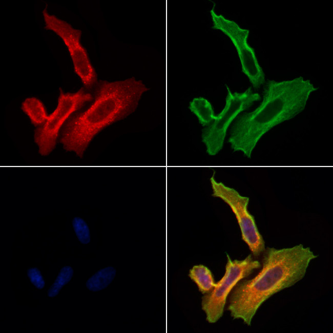 RhoB Antibody in Immunocytochemistry (ICC/IF)