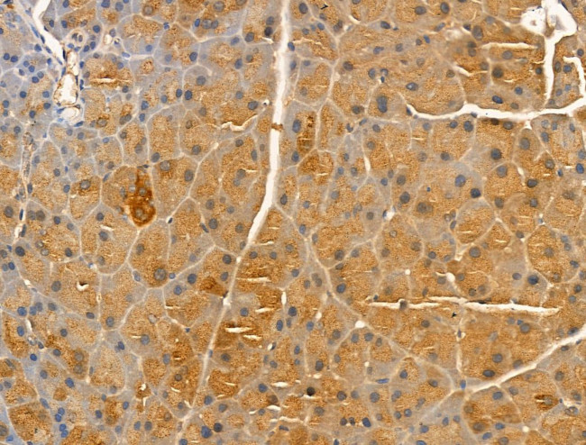 RPL26 Antibody in Immunohistochemistry (Paraffin) (IHC (P))