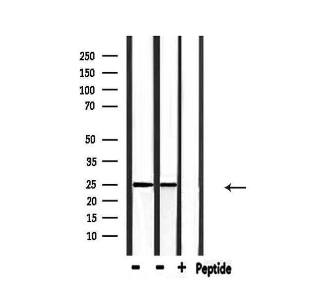 RIT1 Antibody in Western Blot (WB)