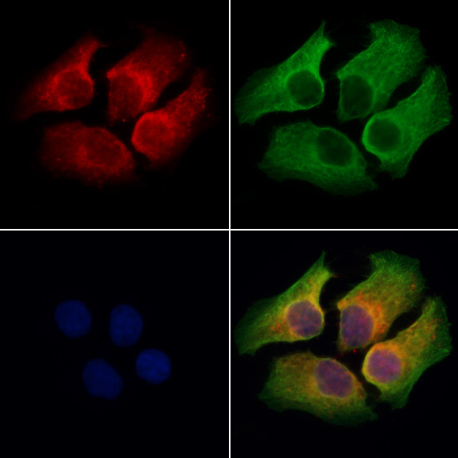 RNF31 Antibody in Immunocytochemistry (ICC/IF)