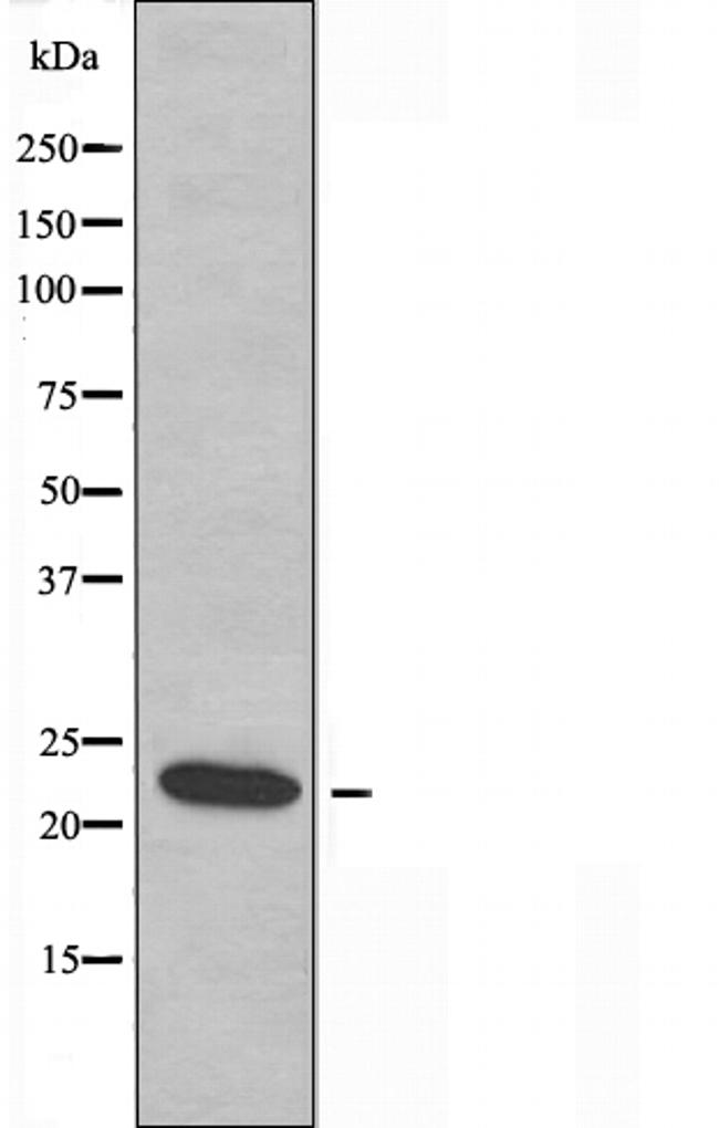 RPS9 Antibody in Western Blot (WB)