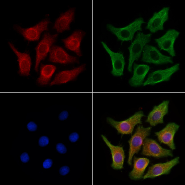 S100A6 Antibody in Immunocytochemistry (ICC/IF)