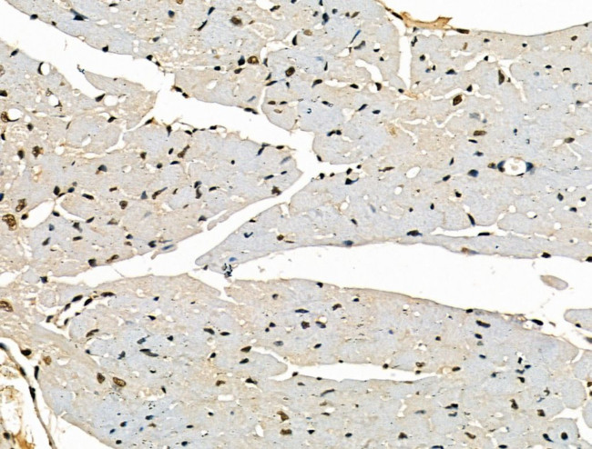 STAG1 Antibody in Immunohistochemistry (Paraffin) (IHC (P))