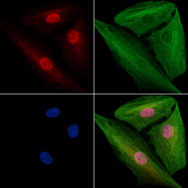 SF3B1 Antibody in Immunocytochemistry (ICC/IF)