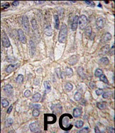 P-cadherin Antibody in Immunohistochemistry (Paraffin) (IHC (P))