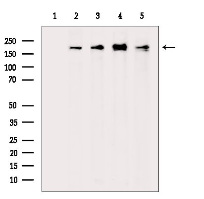 SCRIB Antibody in Western Blot (WB)