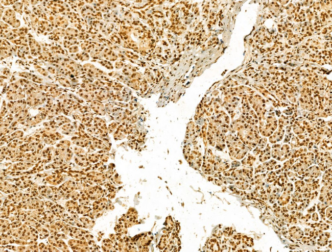 SCXA Antibody in Immunohistochemistry (Paraffin) (IHC (P))