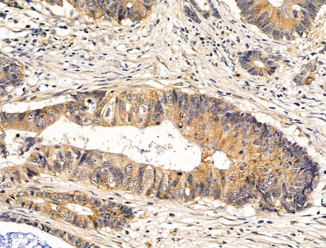 SDCCAG3 Isoform 1 Antibody in Immunohistochemistry (Paraffin) (IHC (P))