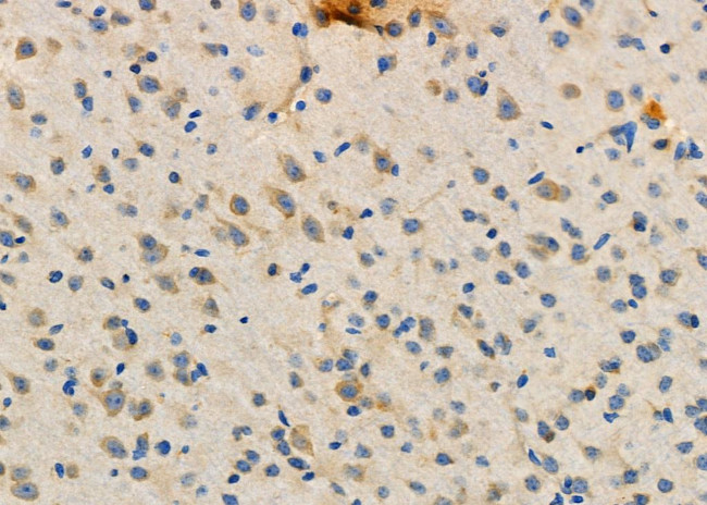 CD62L Antibody in Immunohistochemistry (Paraffin) (IHC (P))