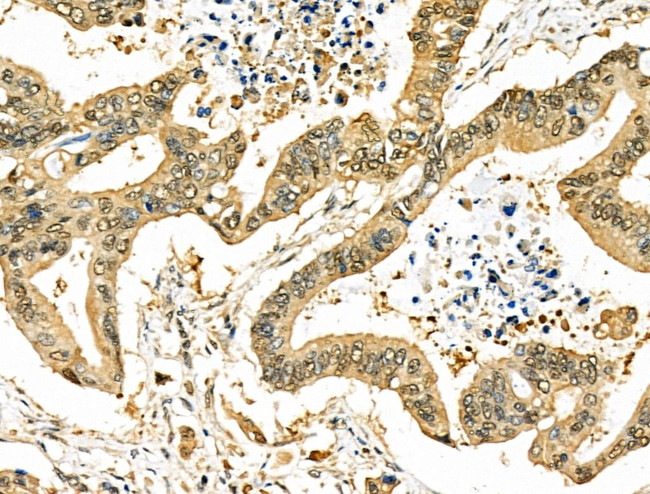SIRT7 Antibody in Immunohistochemistry (Paraffin) (IHC (P))