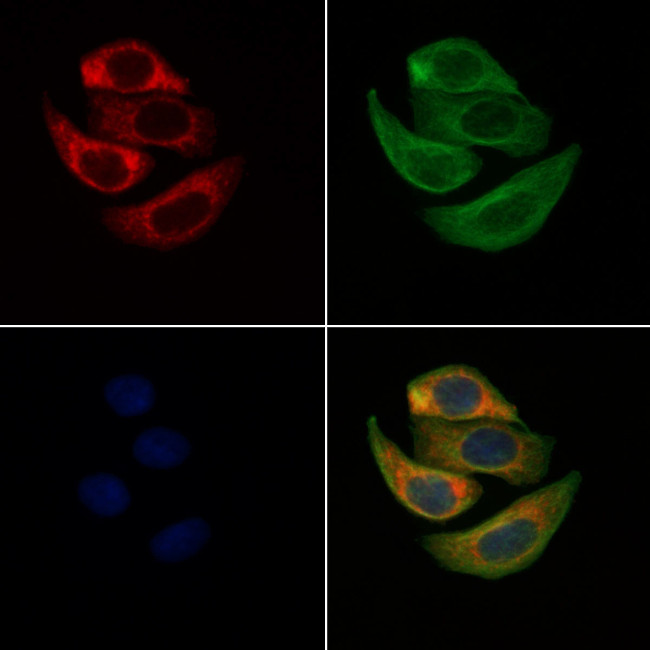 SLC10A7 Antibody in Immunocytochemistry (ICC/IF)