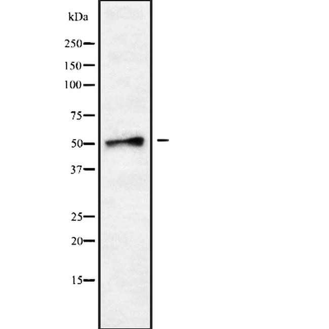 SLC18A1 Antibody in Western Blot (WB)