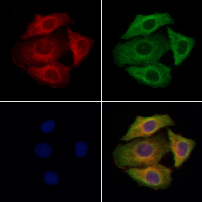 SLC26A4 Antibody in Immunocytochemistry (ICC/IF)