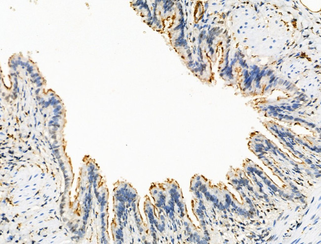 CTR1 Antibody in Immunohistochemistry (Paraffin) (IHC (P))