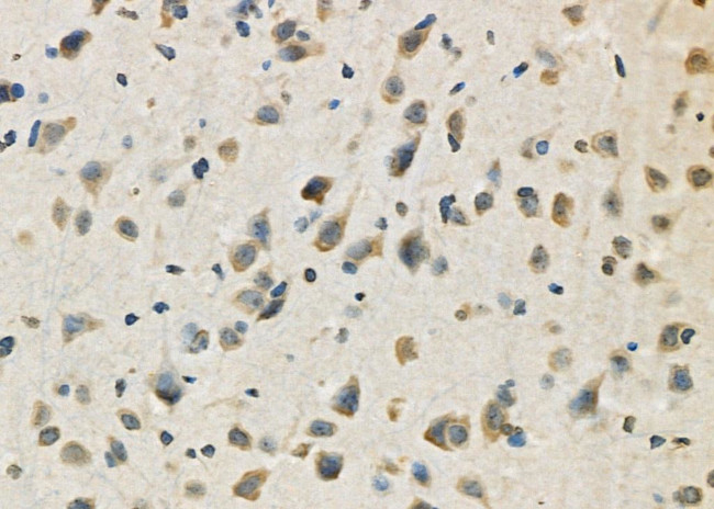 CD98 Antibody in Immunohistochemistry (Paraffin) (IHC (P))