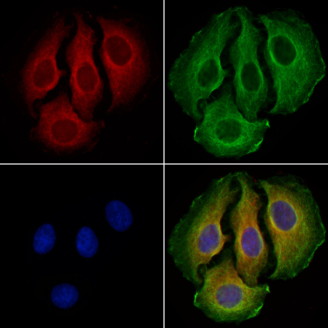 SLCO1C1 Antibody in Immunocytochemistry (ICC/IF)