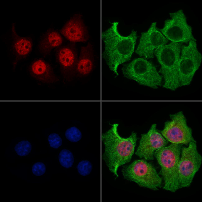 SLFN11 Antibody in Immunocytochemistry (ICC/IF)
