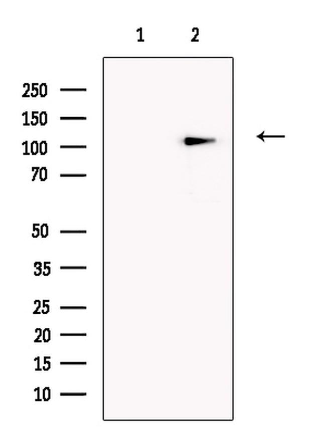 SLFN14 Antibody in Western Blot (WB)